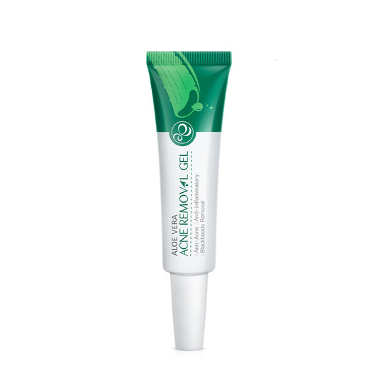 Aloe Vera Anti-Acne Treatment Gel – Soothing Cream Serum, Reduced Pores and Balanced Hydration