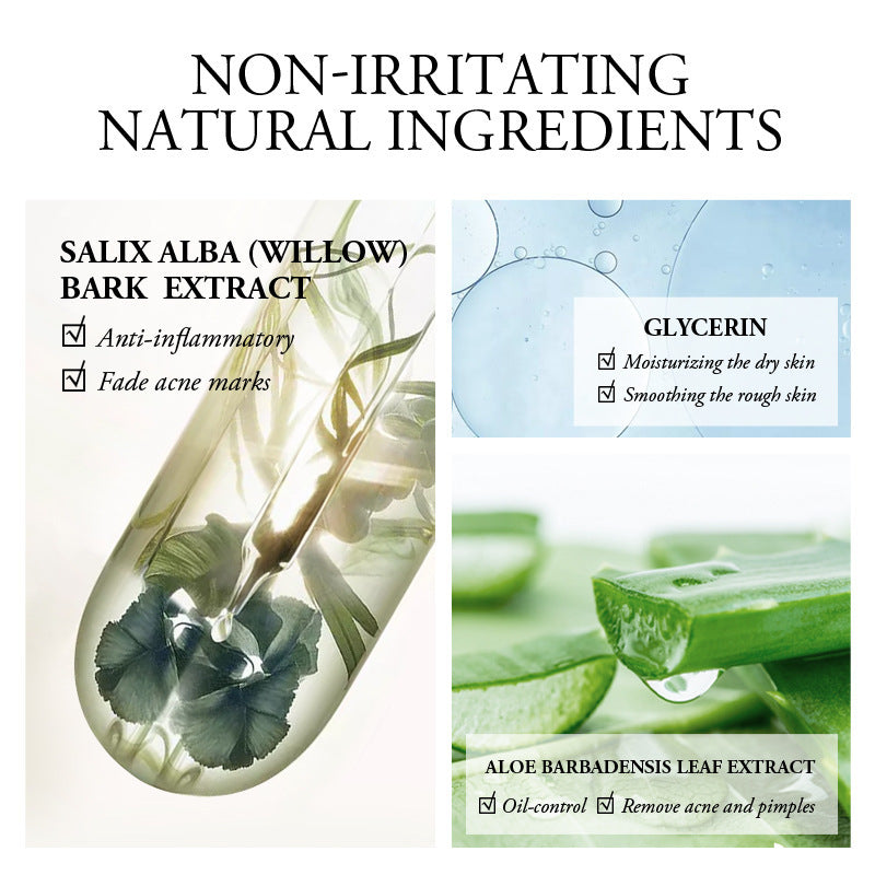 Aloe Vera Anti-Acne Treatment Gel – Soothing Cream Serum, Reduced Pores and Balanced Hydration