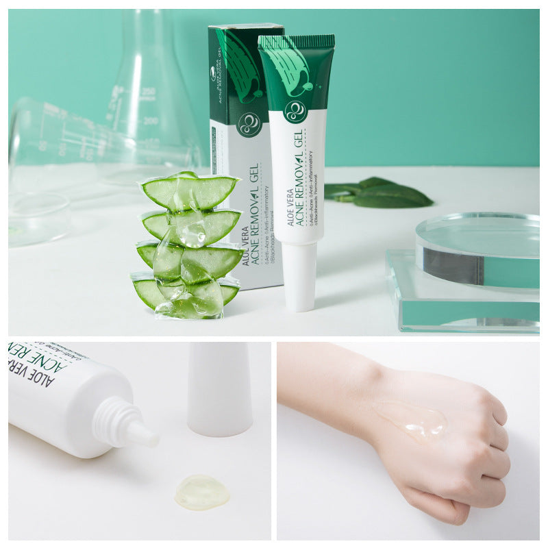 Aloe Vera Anti-Acne Treatment Gel – Soothing Cream Serum, Reduced Pores and Balanced Hydration